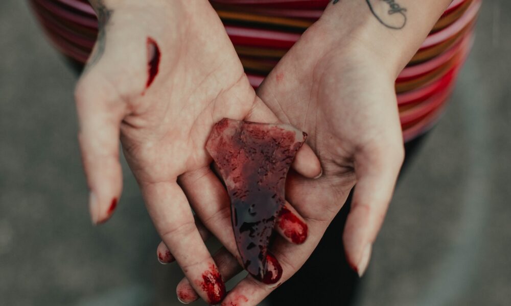 Accident Lawyers in Las Vegas