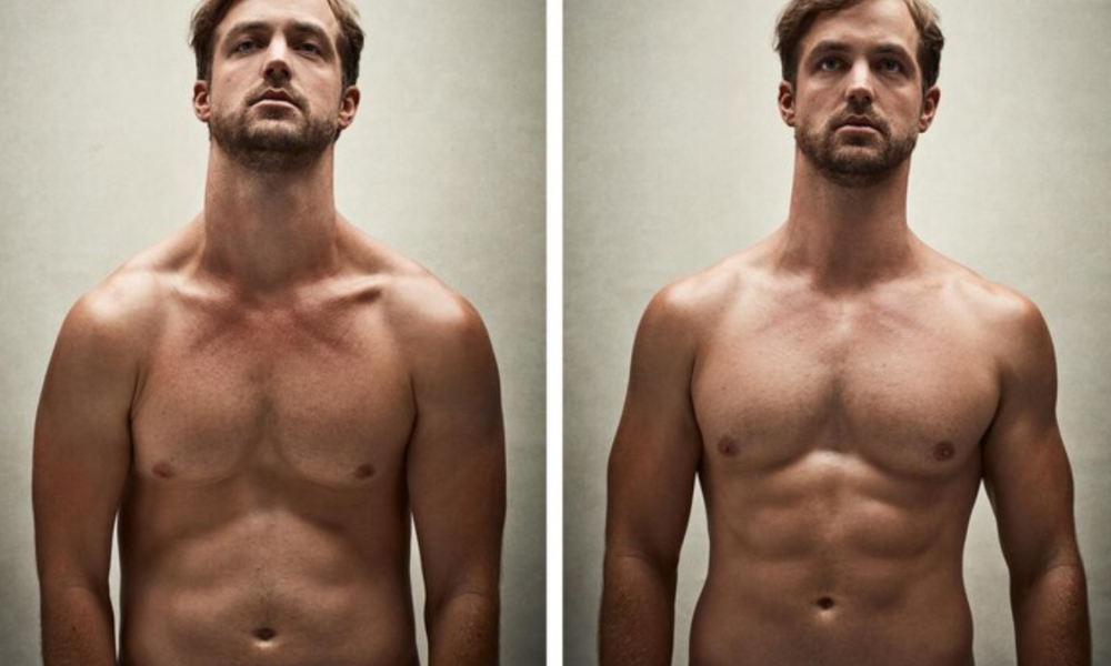 CoolSculpting Before and After