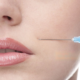 Botox