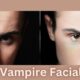 Vampire Facial