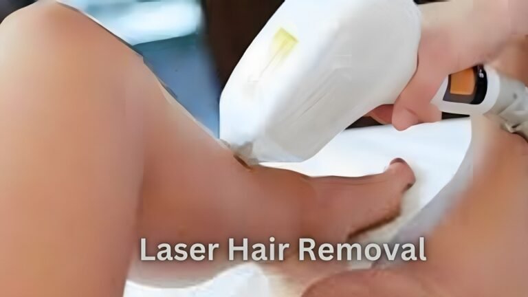 Laser Hair Removal