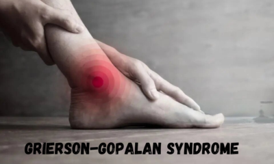 Grierson-Gopalan Syndrome