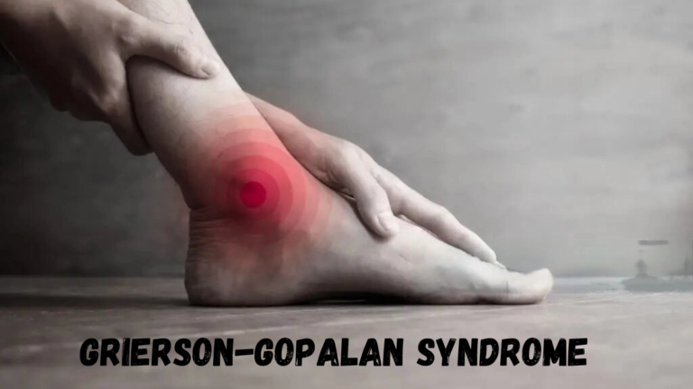 Grierson-Gopalan Syndrome